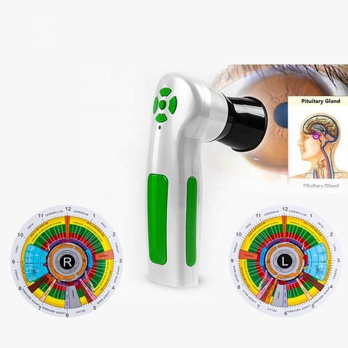 Analizzatore iriscopio occhi - analizzatore,