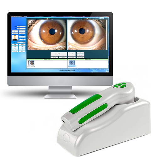 Camara iridologia 12mp - camara,
