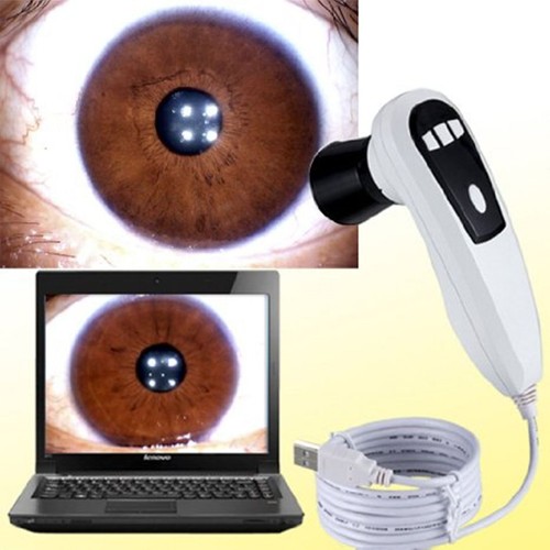 Migliore fotocamera iridologia