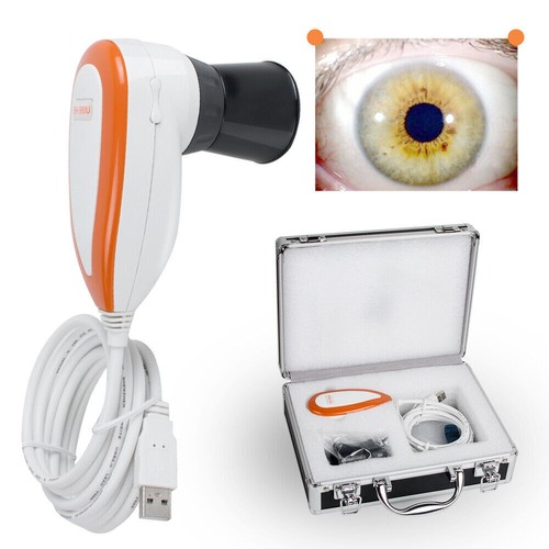 Nuovo usb iriscope - usb,