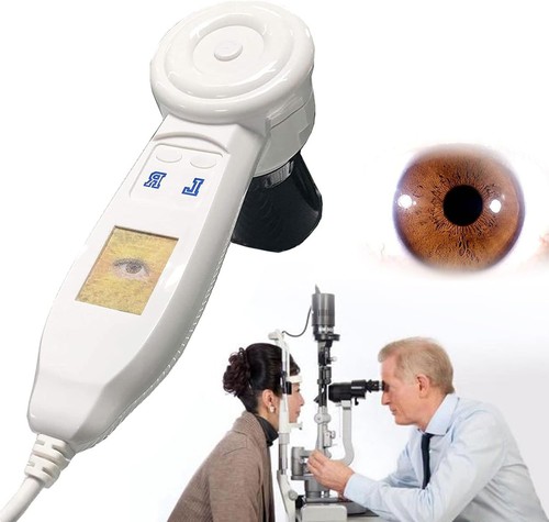 Fotocamera sistema - 5, mp
