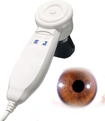 Iriscope mirror mp usb - mirror,